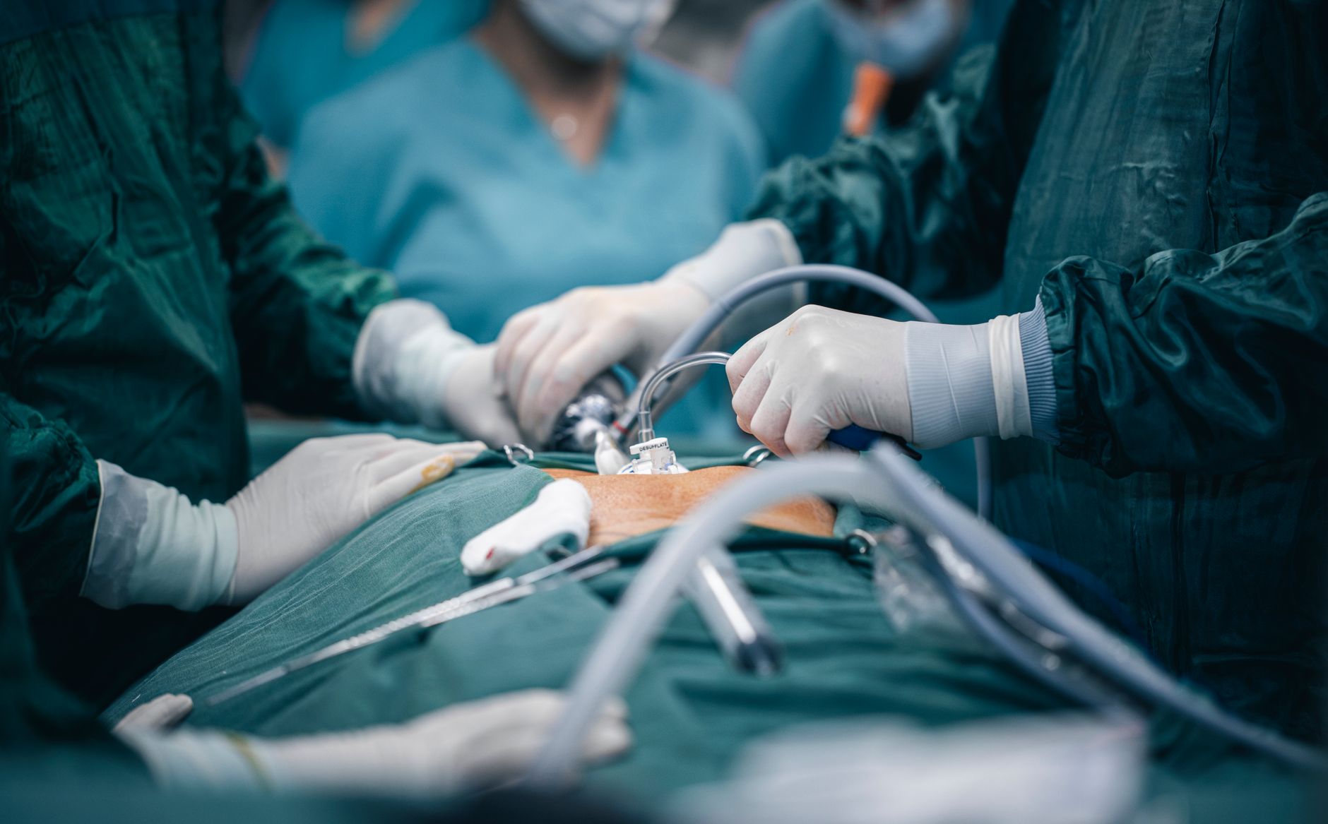 Why Intuitive Surgical stock is rising today