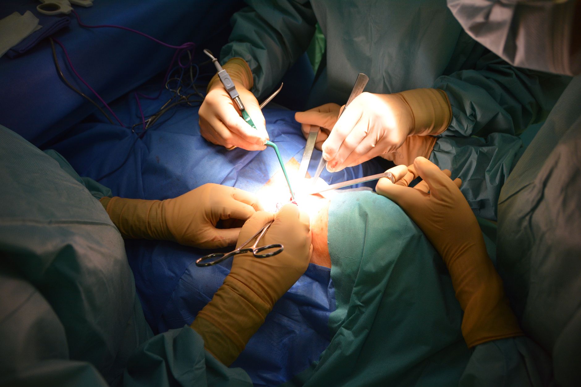 Why Profound Medical Corp stock surged yesterday