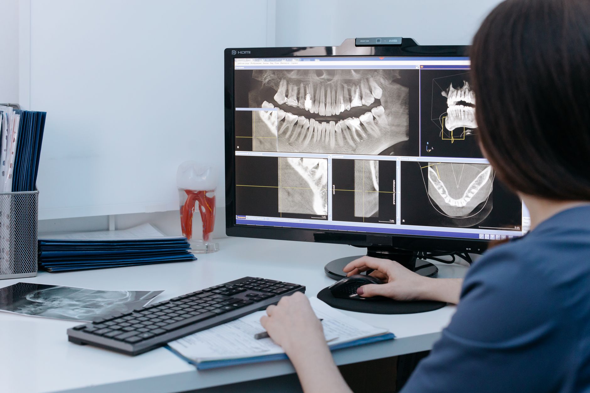 Why Perimeter Medical Imaging AI Inc stock is skyrocketing today