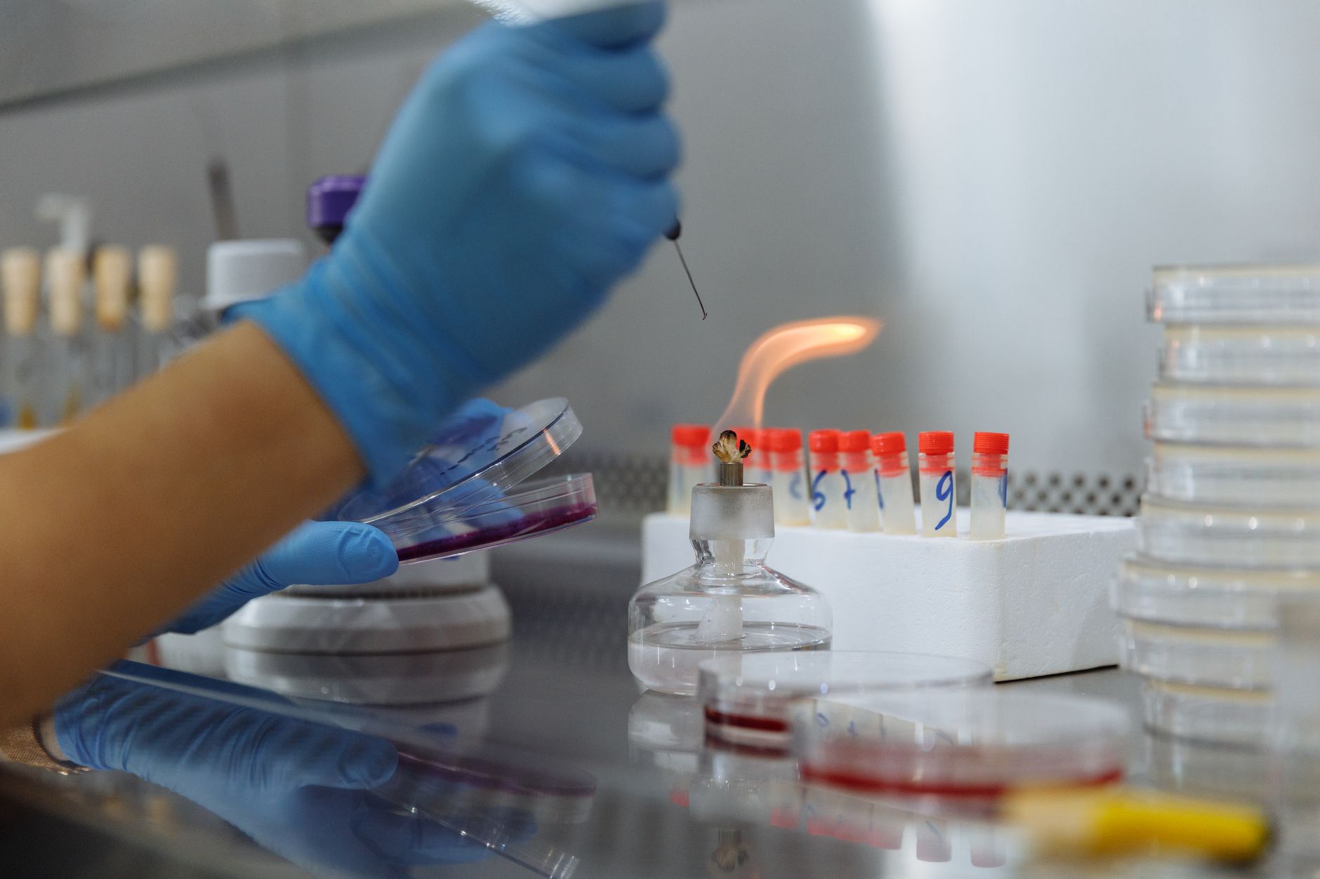 Will Helix BioPharma Corp. (HBP) Beat Earnings Estimates in Its Next Report?