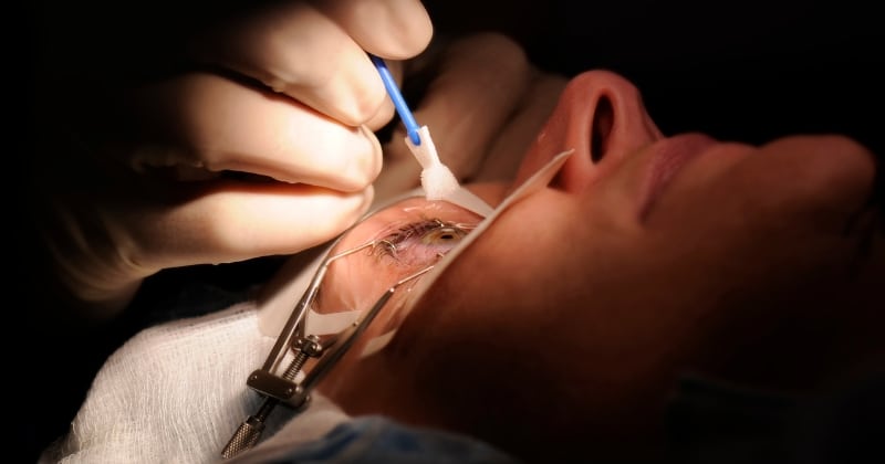 LASIK Eye Surgery Cost in Canada (2026): Get 20/20 Vision