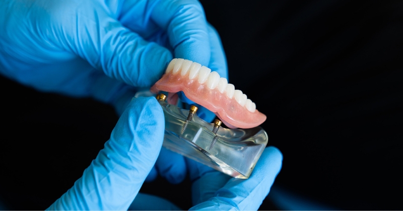 The 3 Types Of Dentures You Can Choose From